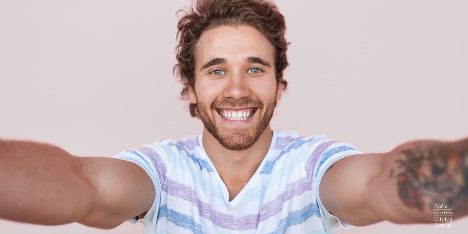 carillas-dentales-composite-en-valencia Carillas Dentales de Composite en Valencia