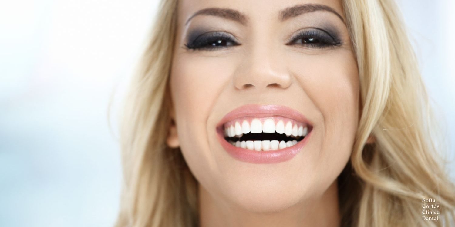 carillas-porcelana-valencia-sofia-cortes carillas-porcelana-valencia-sofia-cortes