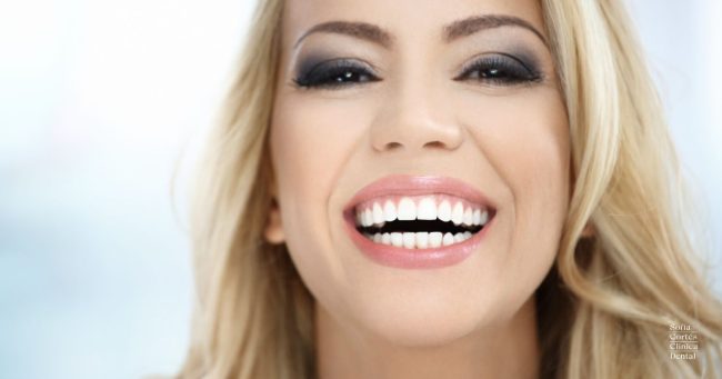 carillas-porcelana-valencia-sofia-cortes carillas-porcelana-valencia-sofia-cortes