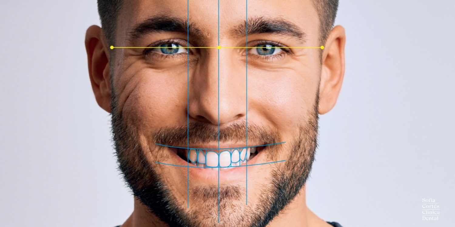 invisalign-smile-architect-ortodoncia-invisible-valencia Invisalign Smile Architect - Ortodoncia Invisible Valencia