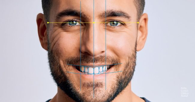 invisalign-smile-architect-ortodoncia-invisible-valencia Invisalign Smile Architect - Ortodoncia Invisible Valencia