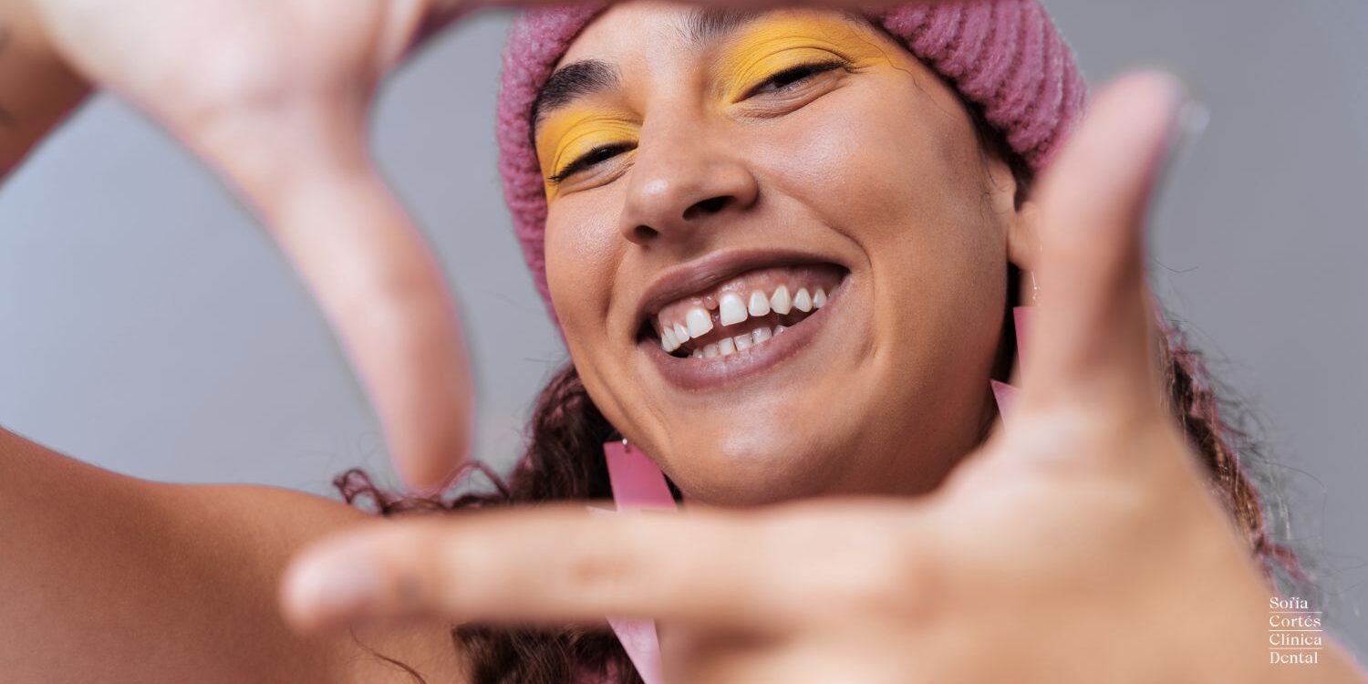 diastemas-dientes-separados-tratamiento-clinica-dental-valencia diastemas-dientes-separados-tratamiento-clinica-dental-valencia