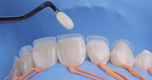 curso-composite-dental-valencia Curso para Odontólogos de composite dental en Valencia