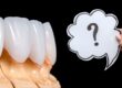 carillas-dentales-preguntas-frequentes
