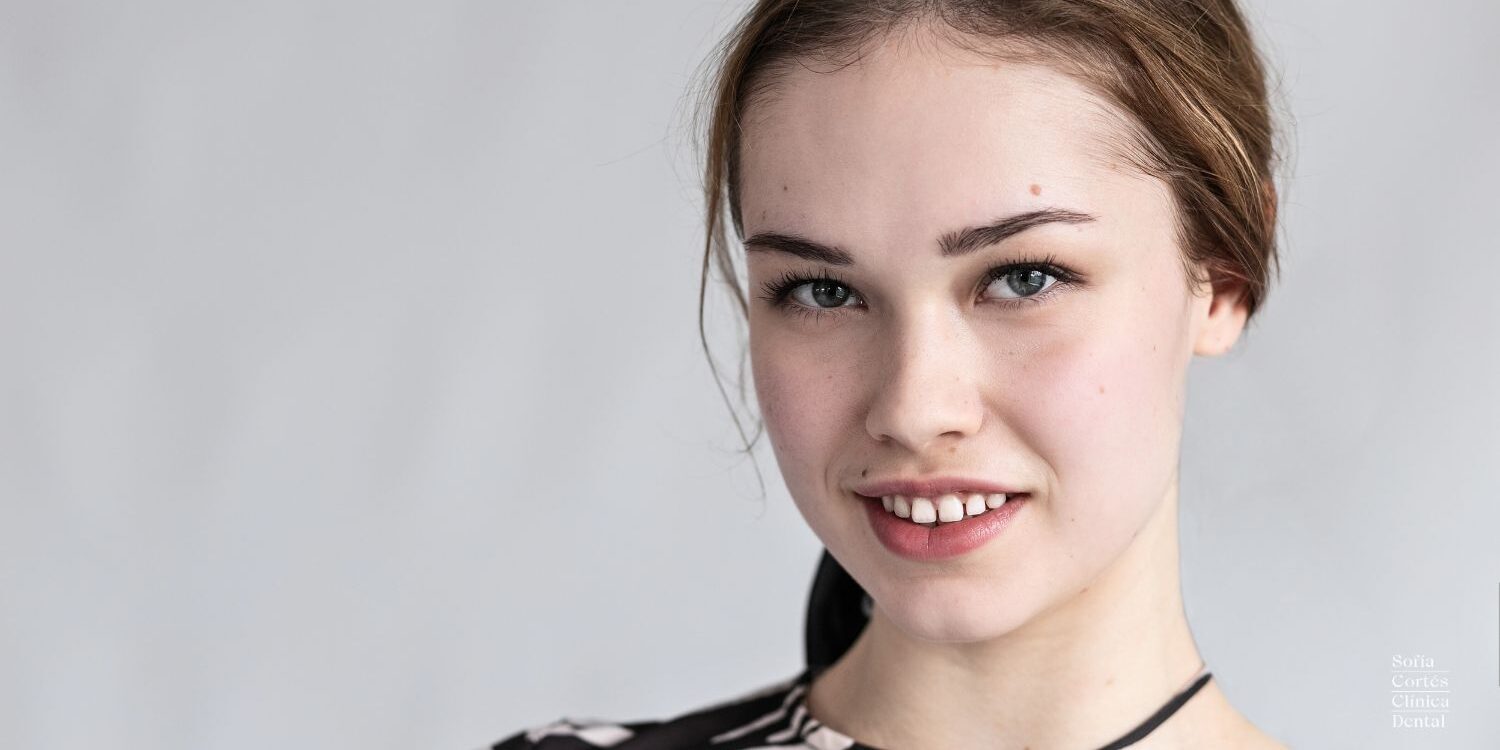 carillas-para-cerrar-espacios-interdentales carillas-para-cerrar-espacios-interdentales