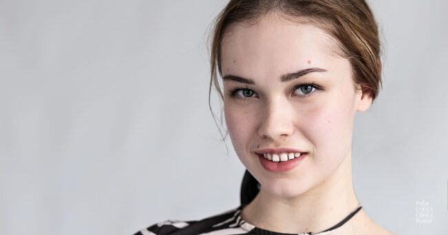 carillas-para-cerrar-espacios-interdentales carillas-para-cerrar-espacios-interdentales