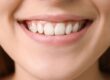 periodontitis-valencia-tratamiento
