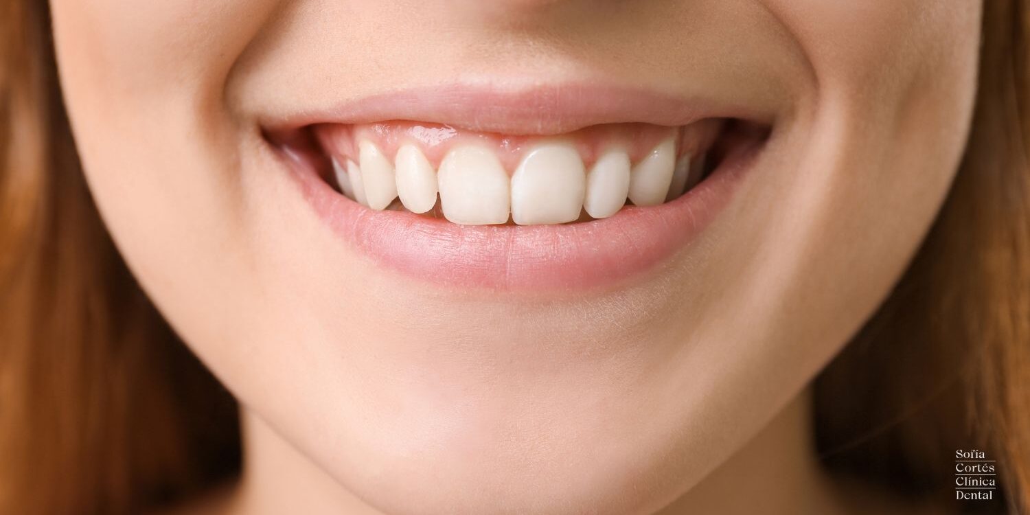 periodontitis-valencia-tratamiento