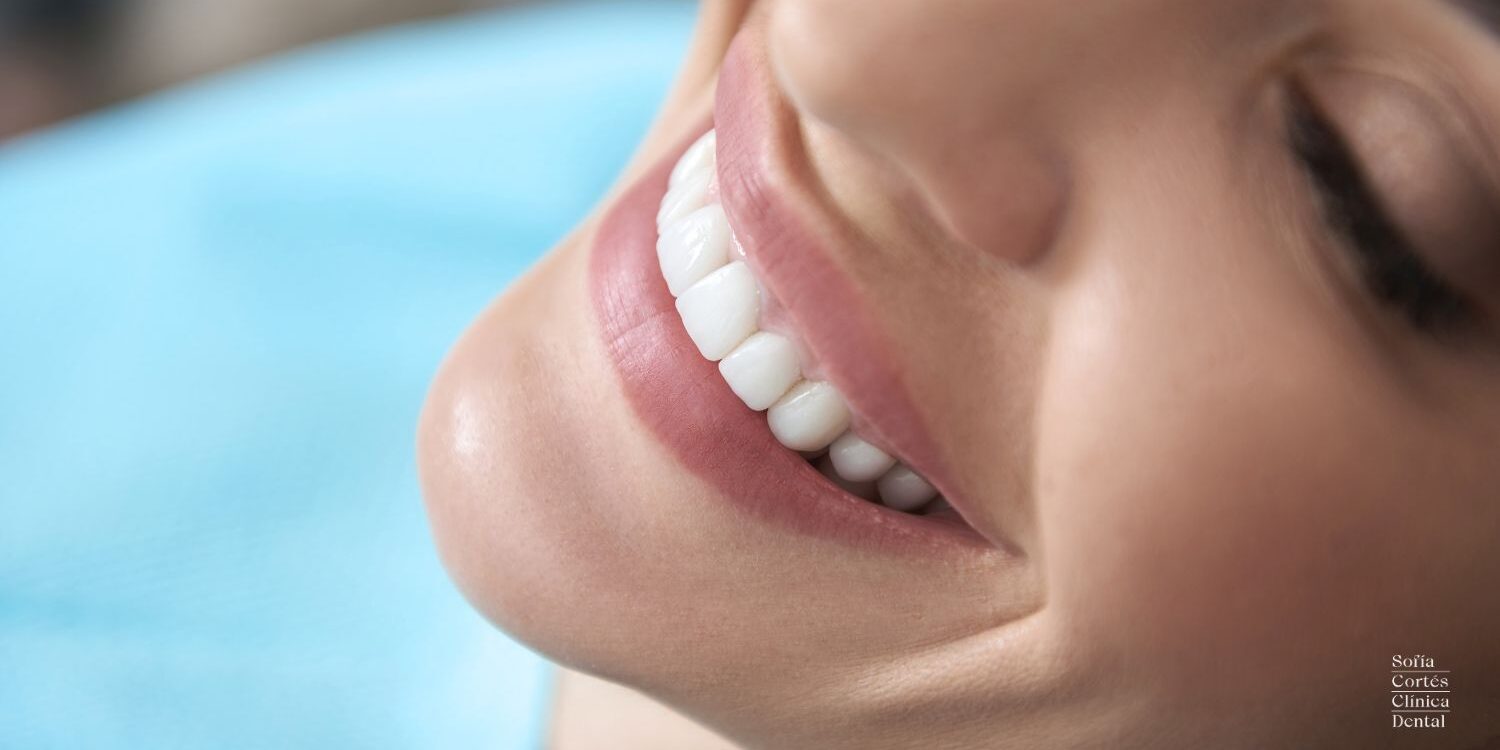 tipos-de-blanqueamiento-dental