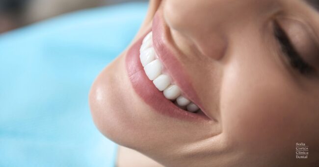 tipos-de-blanqueamiento-dental