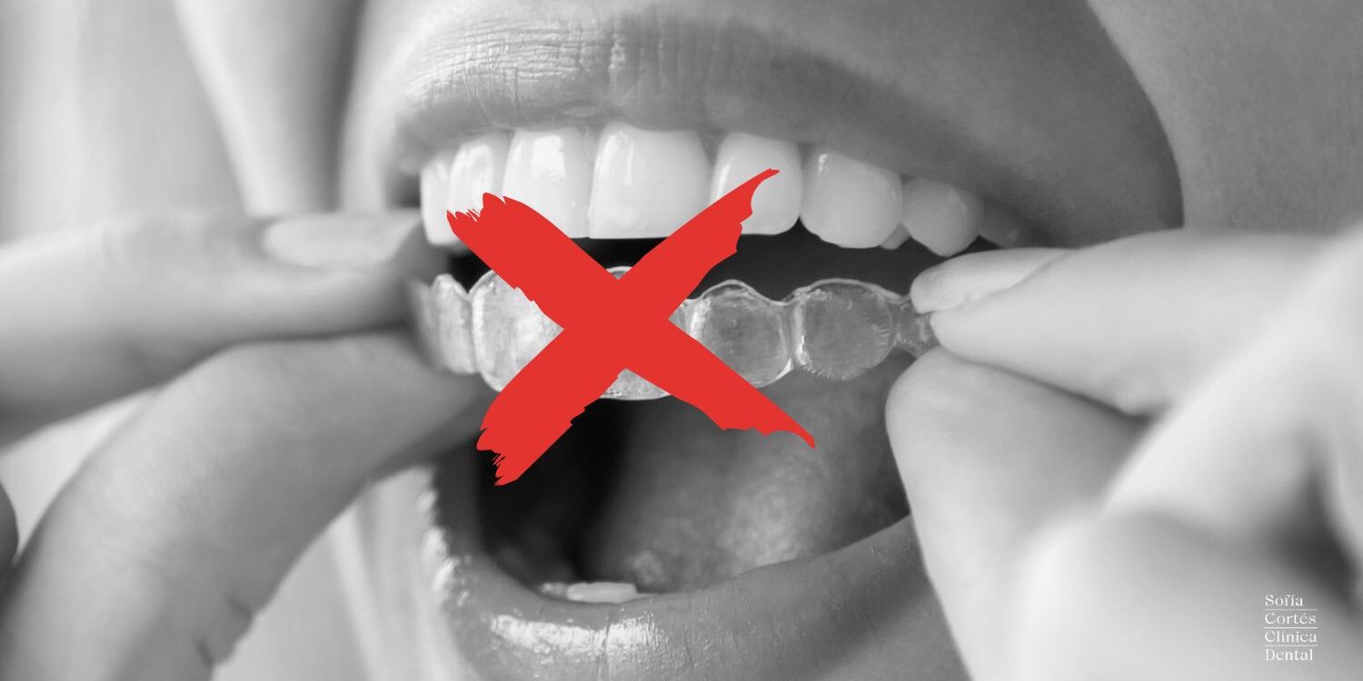 ortodoncia-invisible-cuando-no-se-puede ortodoncia-invisible-cuando-no-se-puede
