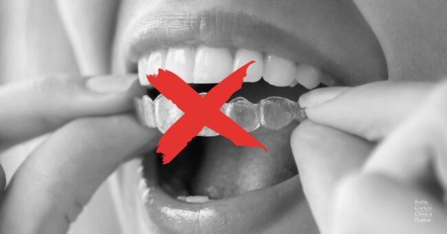 ortodoncia-invisible-cuando-no-se-puede ortodoncia-invisible-cuando-no-se-puede