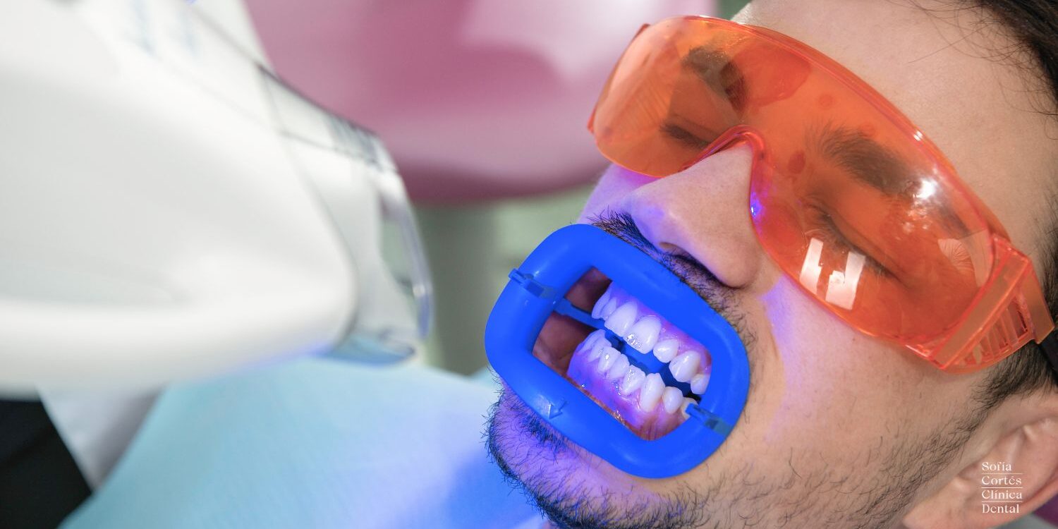 blanqueamiento-dental-preguntas-y-respuestas-frecuentes blanqueamiento-dental-preguntas-y-respuestas-frecuentes