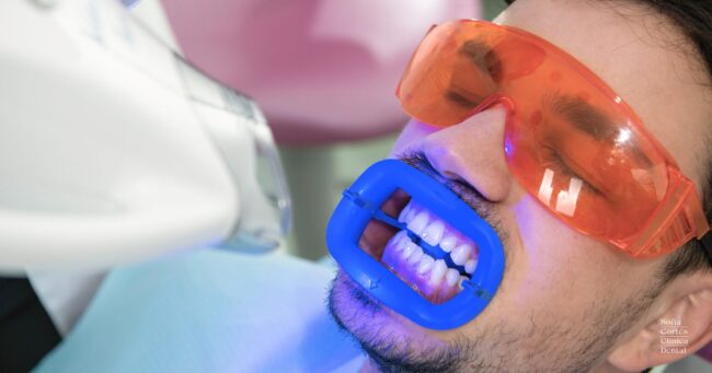 blanqueamiento-dental-preguntas-y-respuestas-frecuentes blanqueamiento-dental-preguntas-y-respuestas-frecuentes