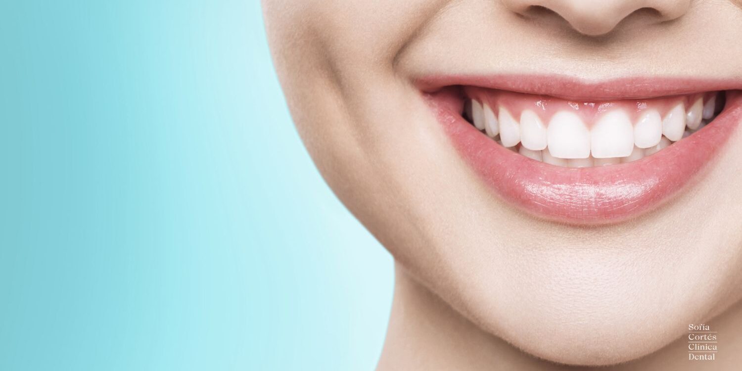 Sofía Cortés – Manchas en los dientes Manchas en los dientes