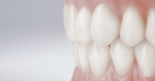 mordida-perfecta-ortodoncia-estetica-salud-valencia mordida-perfecta-ortodoncia-estetica-salud-valencia