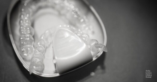 patologias-ortodoncia-invisible-valencia patologias-ortodoncia-invisible-valencia