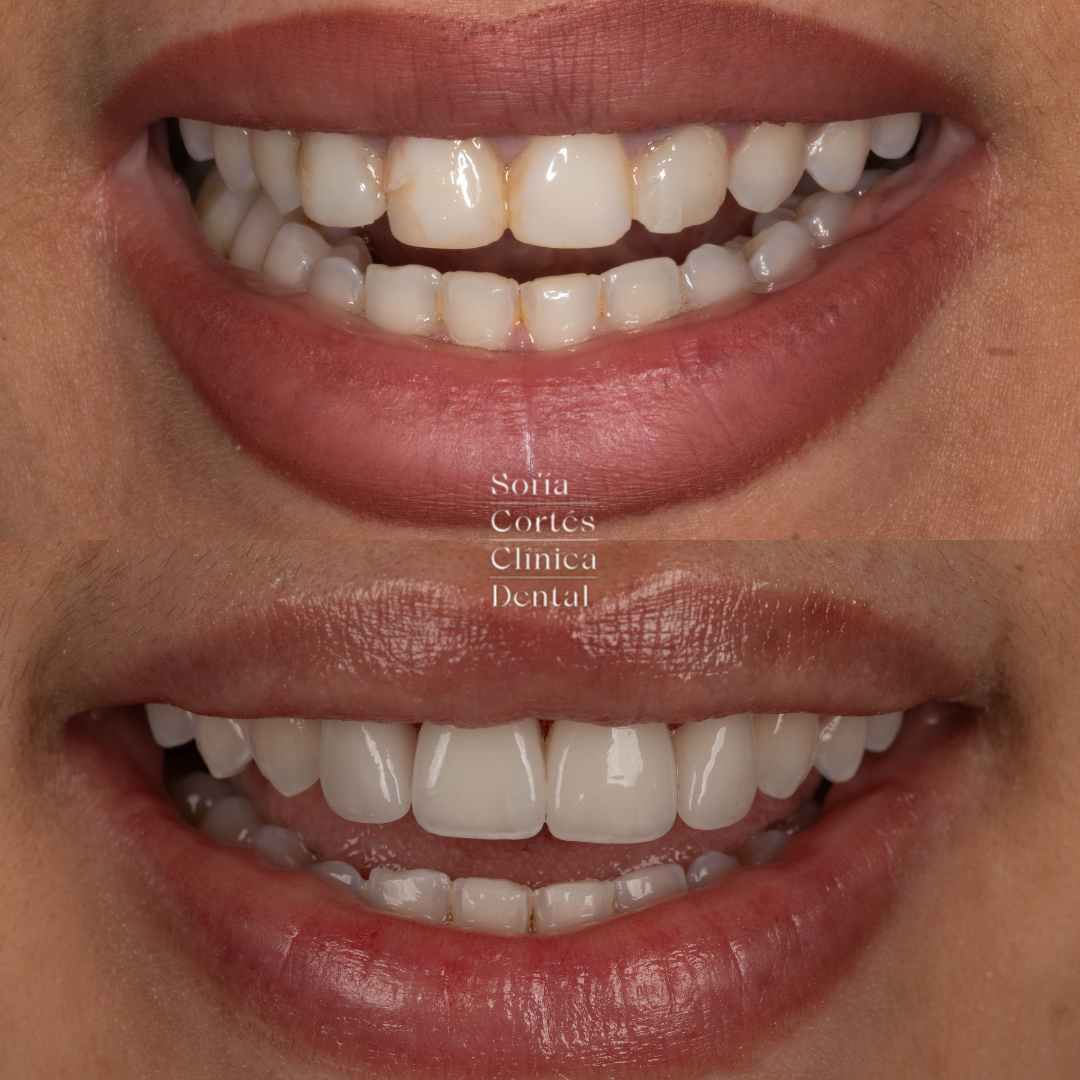 Diseno-sin-titulo-12